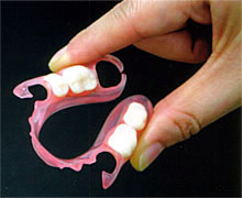 バネなし入れ歯 スマイルデンチャー バネなし入れ歯 スマイルデンチャー