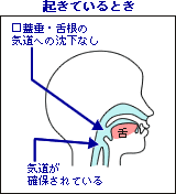 起きているとき