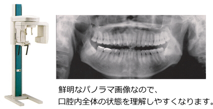最新のデジタルレントゲン 最新のデジタルレントゲン