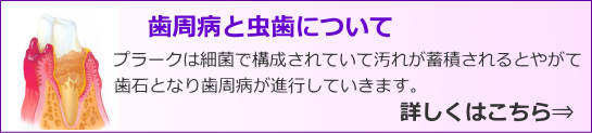 歯周病とむし歯について 歯周病とむし歯について